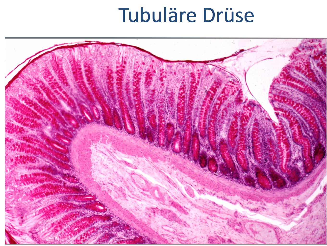 Welche Drüsenform liegt im Colon Dickdarm vor Histologie