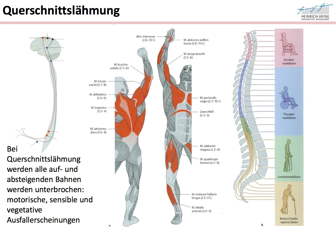 Was passiert bei einer Querschnittslähmung Neuroanatomie Rückenmark