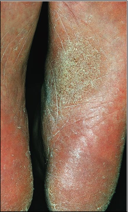 Was ist das? Dermatologie Repetico