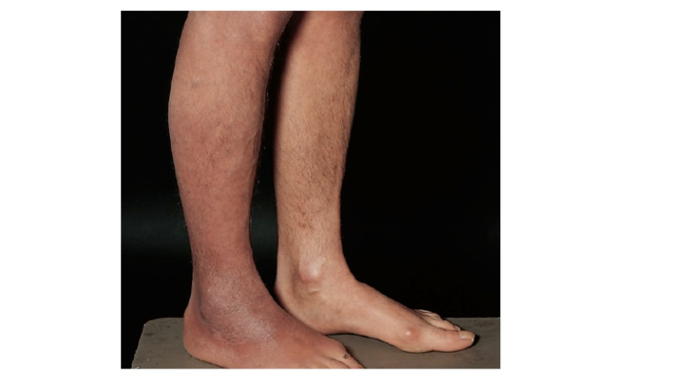 was-ist-das-dermatologie-repetico