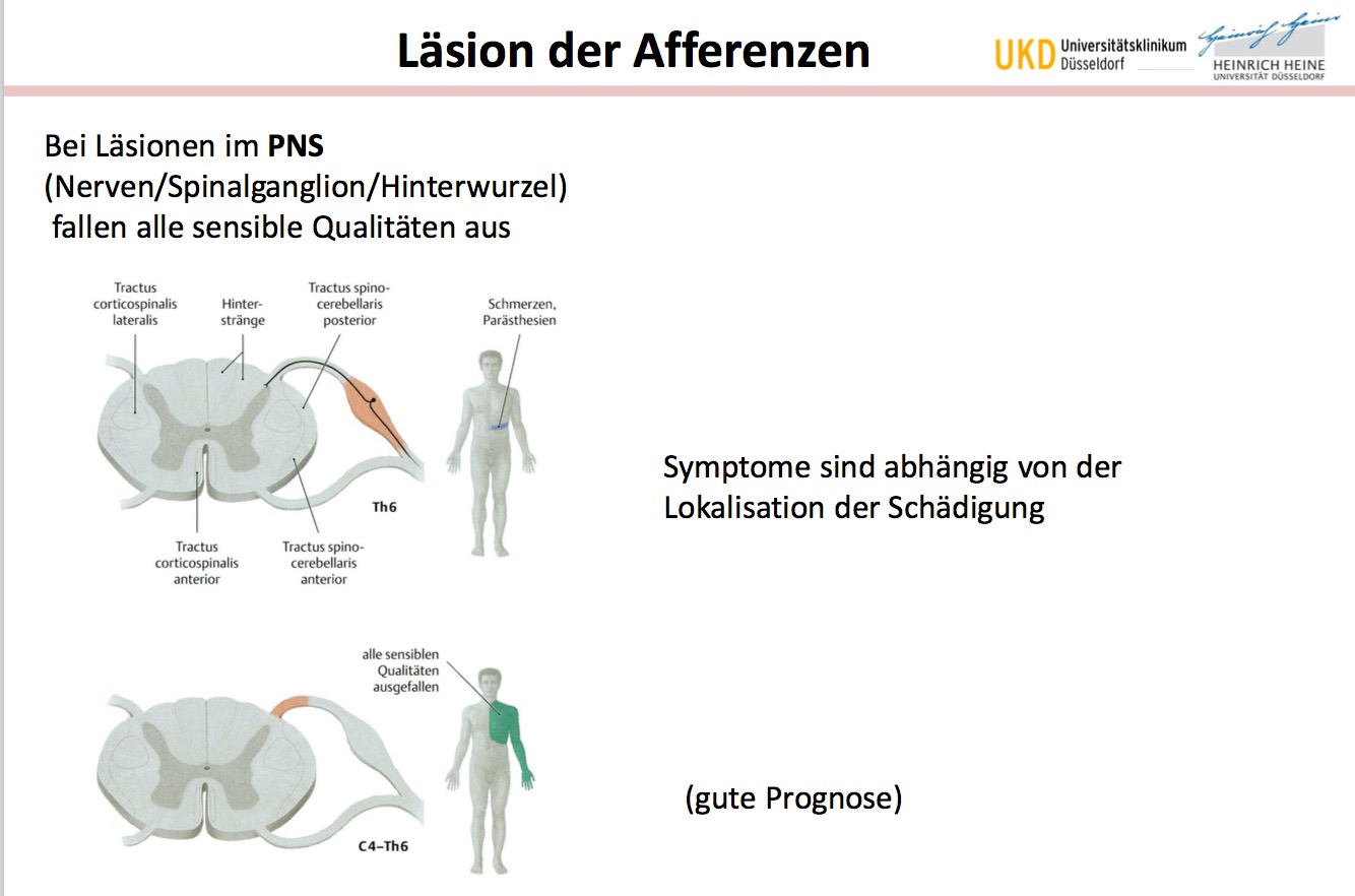 Läsion der Afferenzen im PNS vs. Rückenmarksläsion... Neuroanatomie