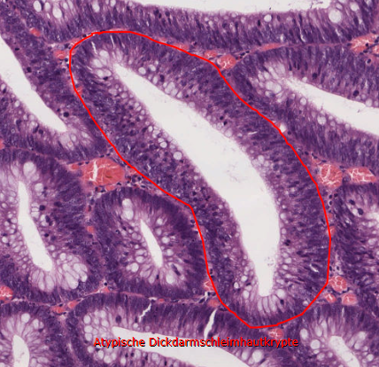 PathoBilder Repetico