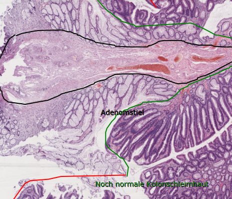 PathoBilder Repetico