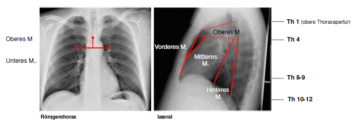 Allgemeine Besonderheiten des Mediastinums | HKL Anatomie | Repetico