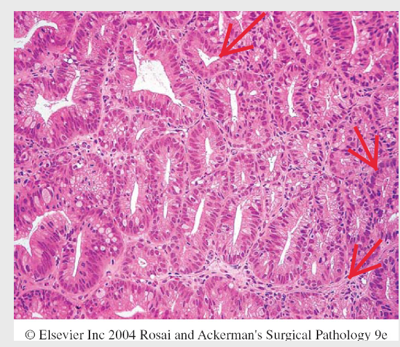 PathoBilder Repetico