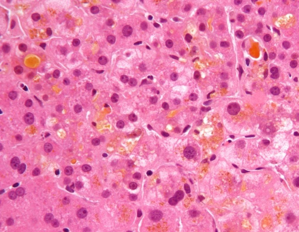 PathoBilder Repetico