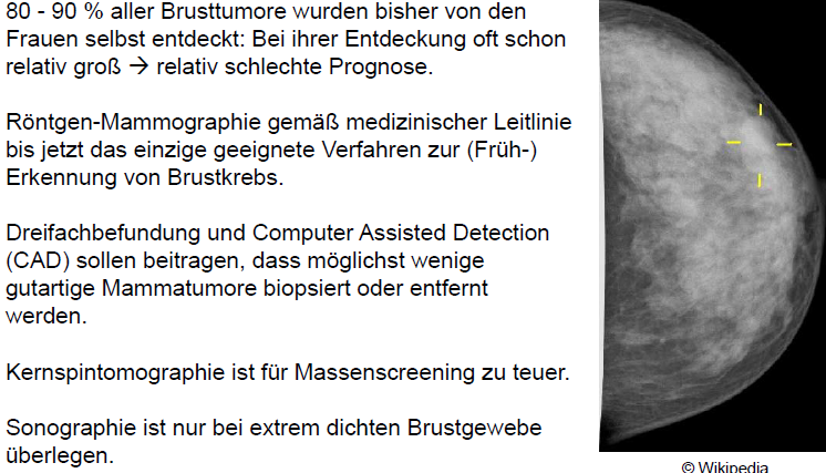 Wie wird Brustkrebs diagnostiziert? | Grundlagen der Medizin für ...