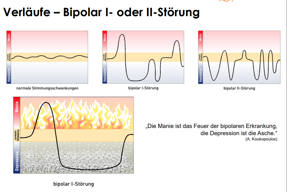 Was Ist Eine Bipolare Störung Einfach Erklärt Bipolare Depression: Diagnosen nach DSM-5, ICD-10 und IC... | Klinische